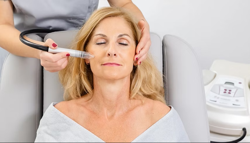 SkinPeeler Mikrodermabrasion – Behandlung
